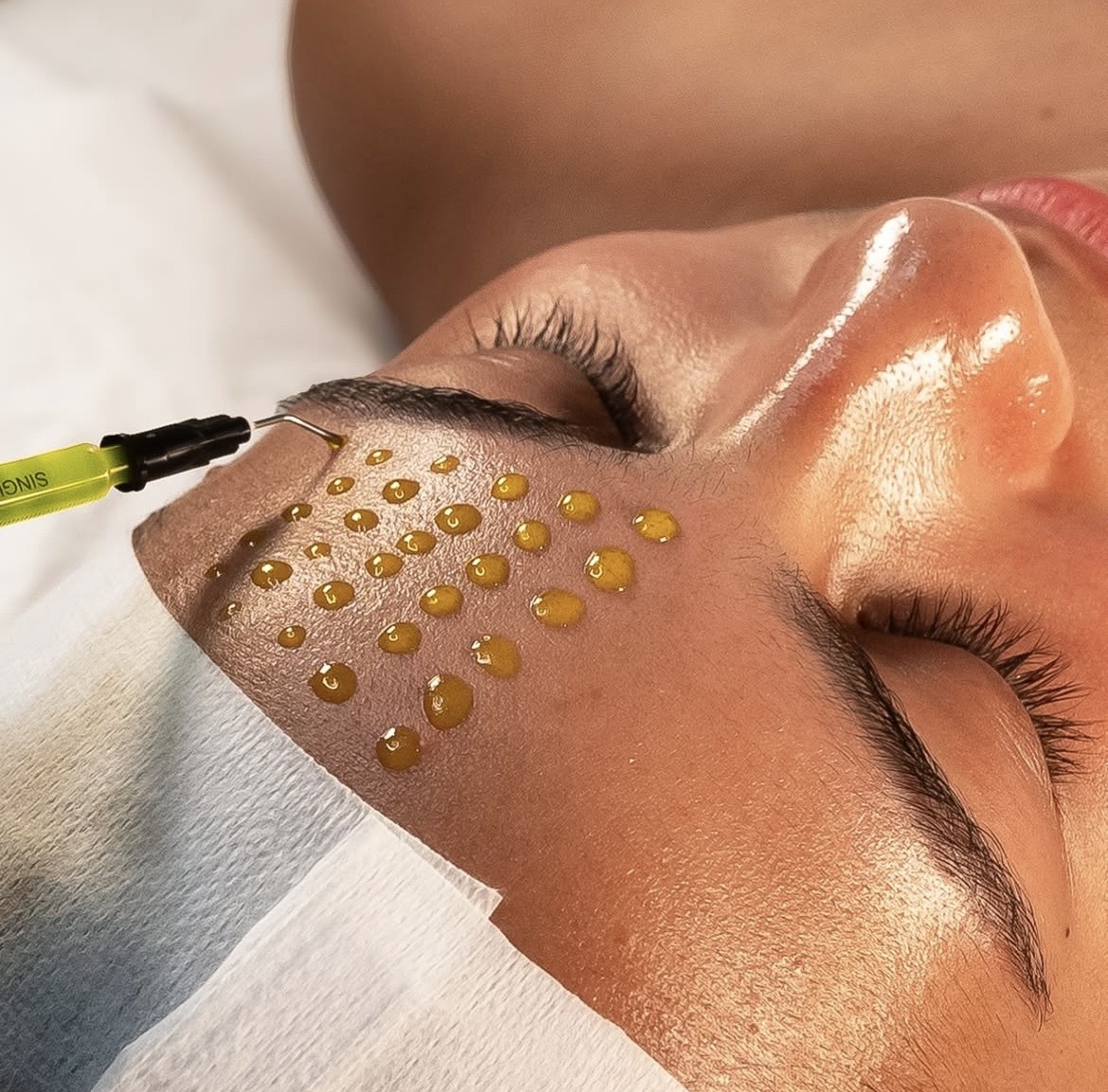 Screenshot Nadelepilation Kempten